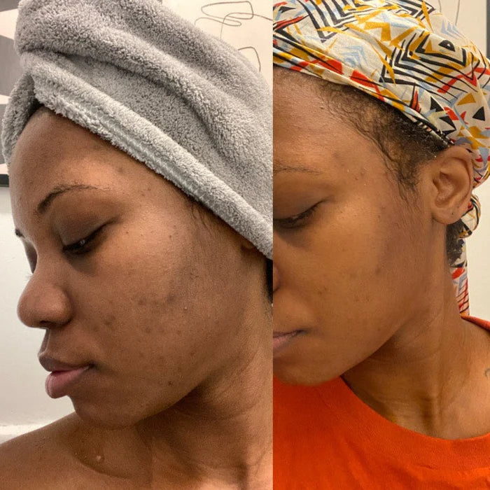 Brume clarifiante au néroli Apoterra skincare